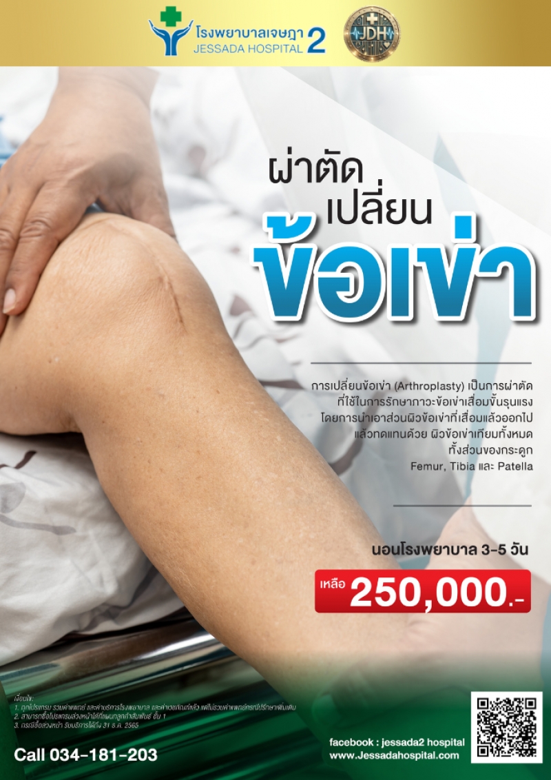 ผ่าตัดเปลี่ยนข้อเข่า